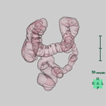 大腸3D画像