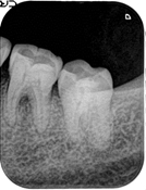 歯（デンタル）の写真